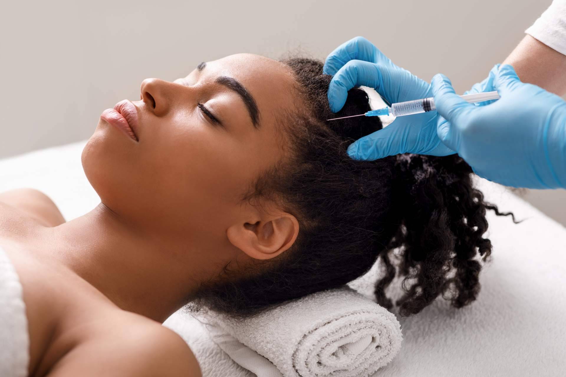 Los beneficios de la mesoterapia capilar de la mano del Dr. Bruno Jacobovski