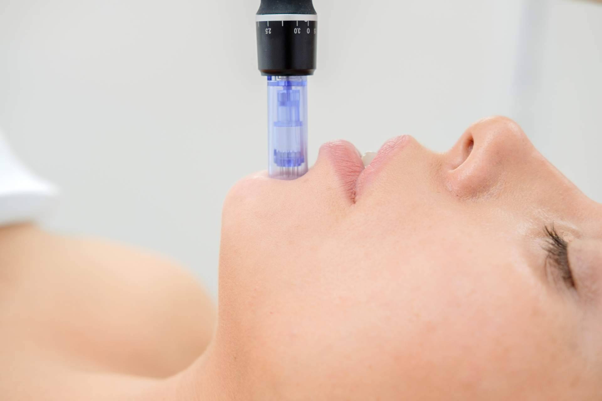 Preparar el rostro esta primavera con los tratamientos faciales de Policlinica ICD