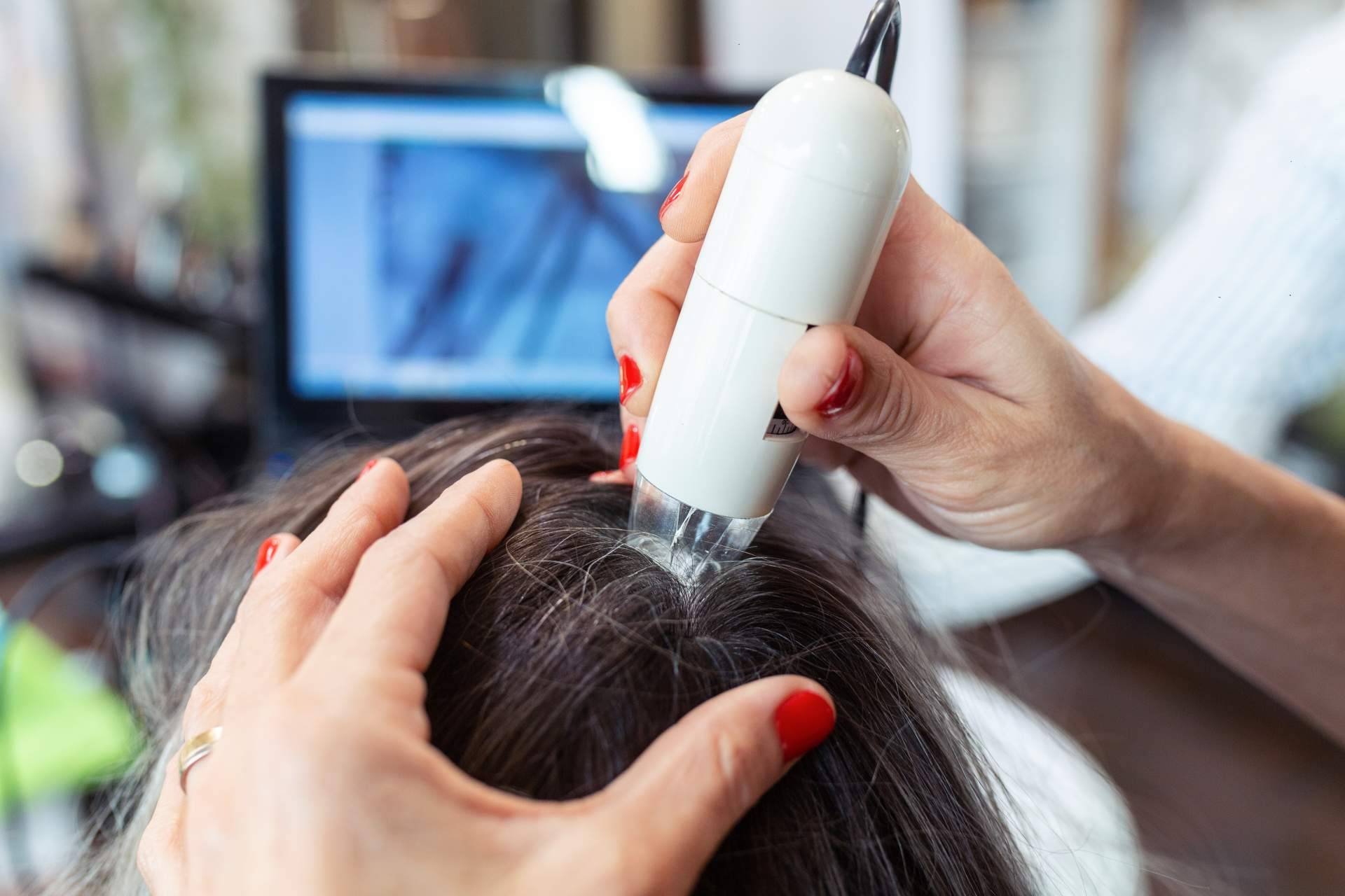CIR cirugia reconstructiva de Capilar Innovation Clinic