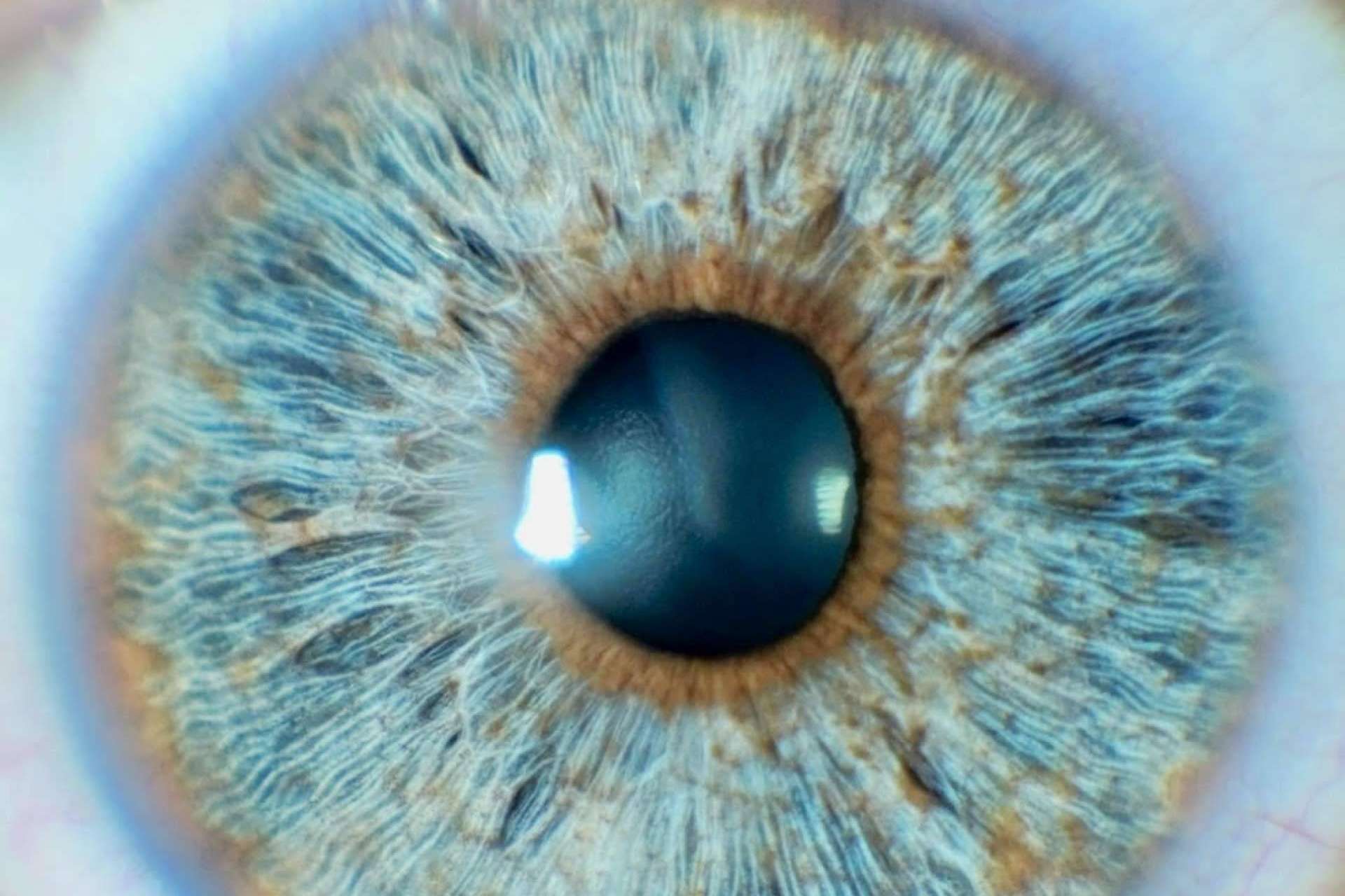 Los avances en las operaciones de cambio de color de ojos con láser, de la mano de Clínica Eyecos