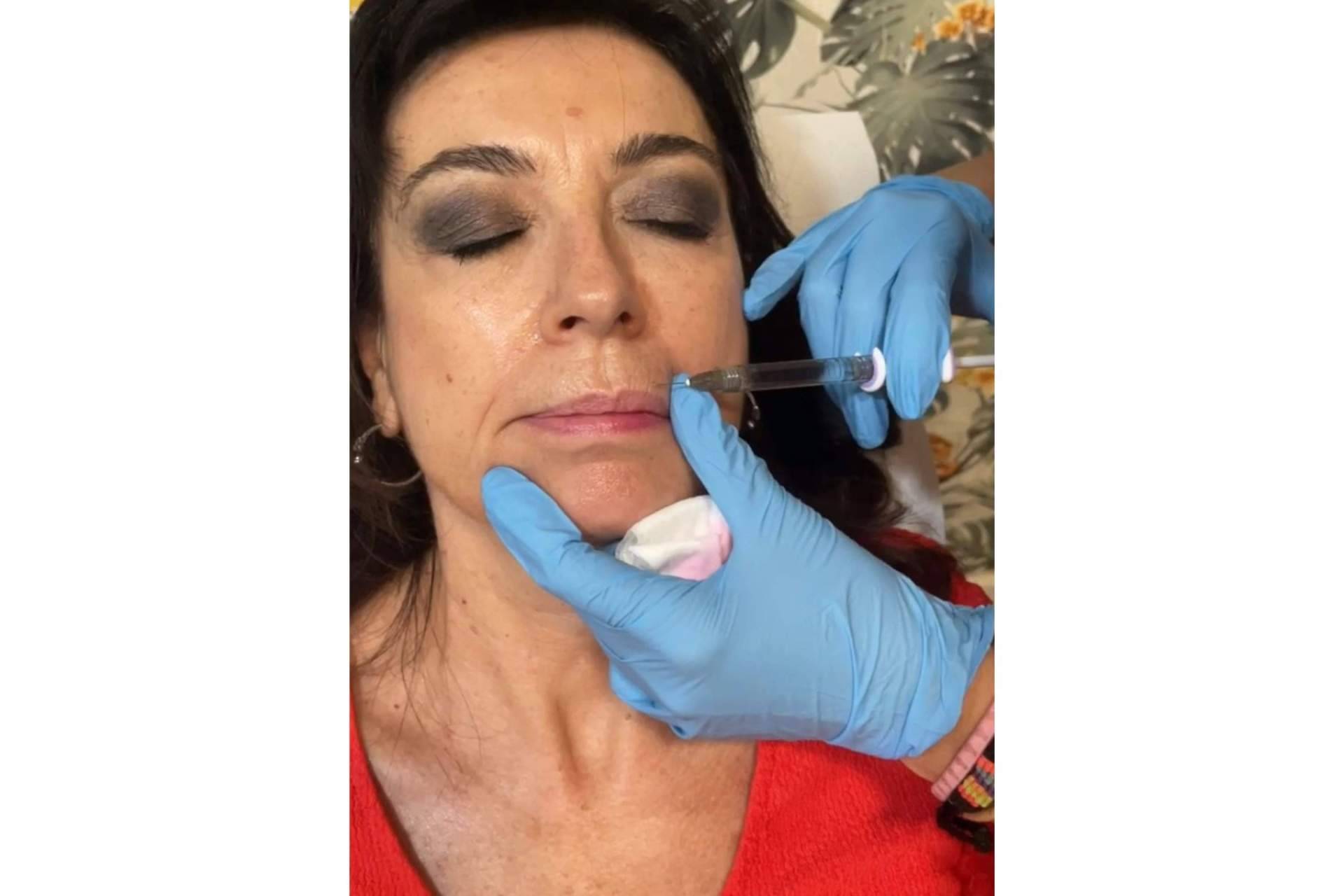 Cecilia Arthur, la clínica estética especializada en blanching