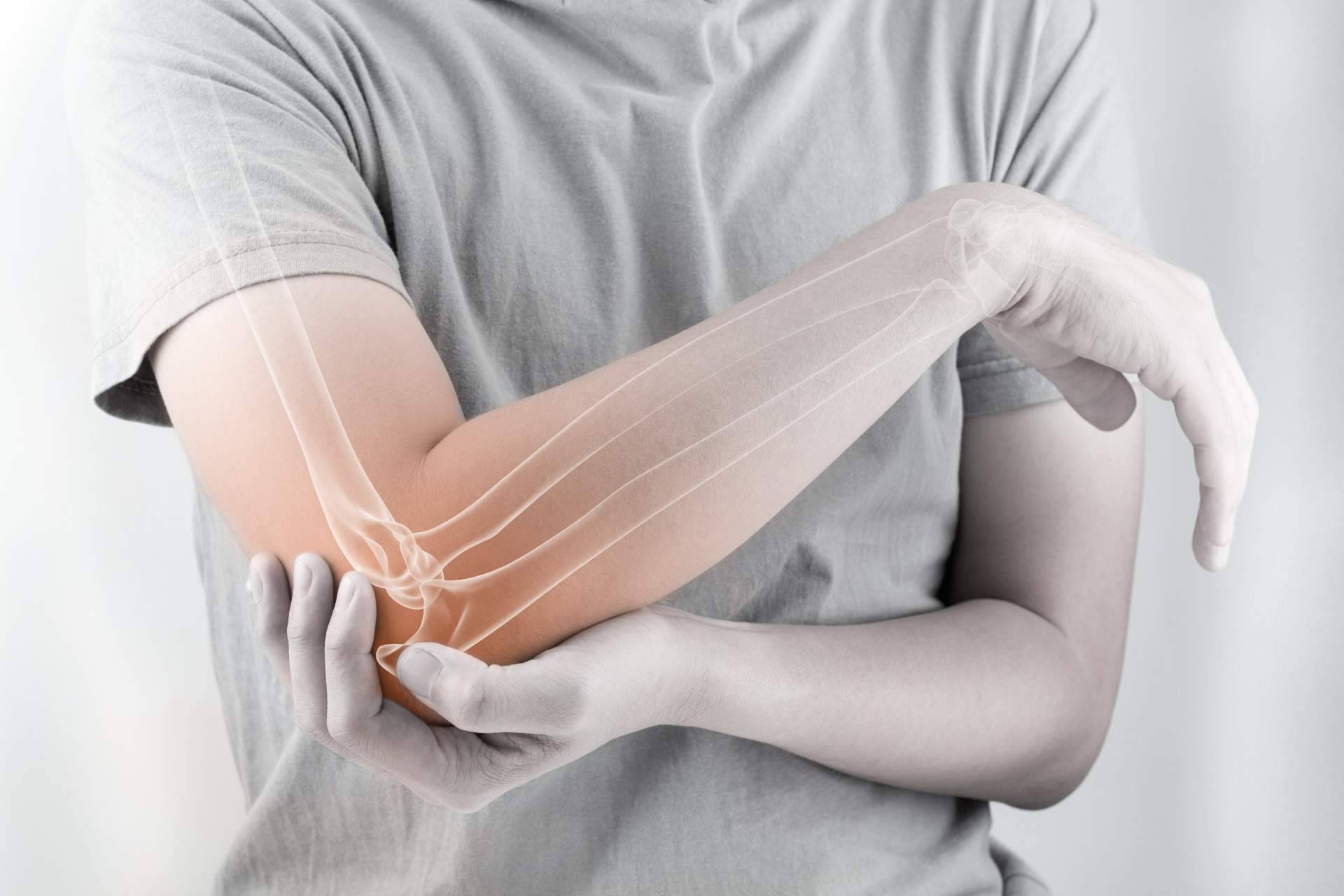 Bibefy ofrece una línea de productos para combatir el dolor articular