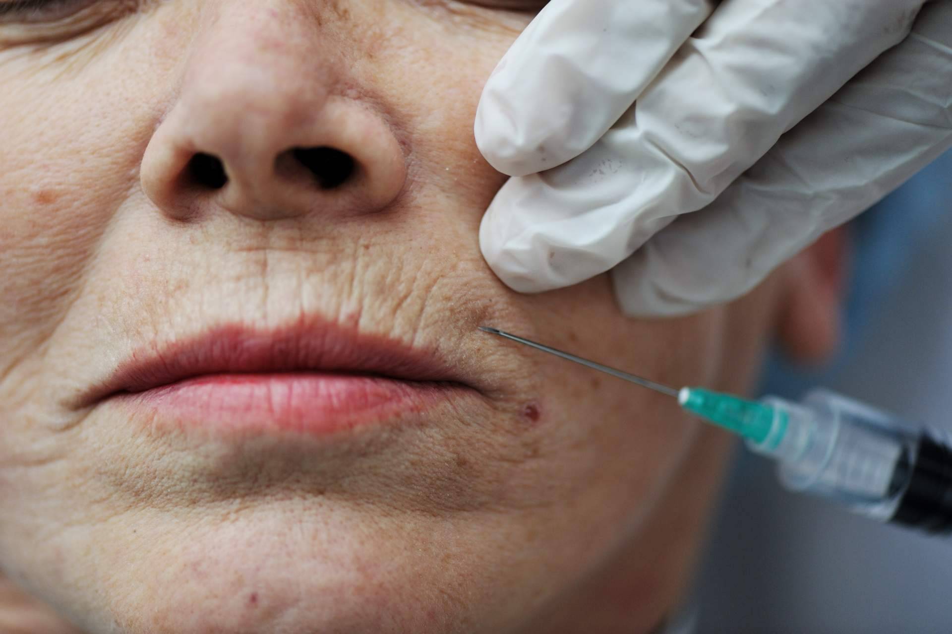 Medicina estética y well aging, la búsqueda segura del envejecimiento saludable y de los resultados naturales