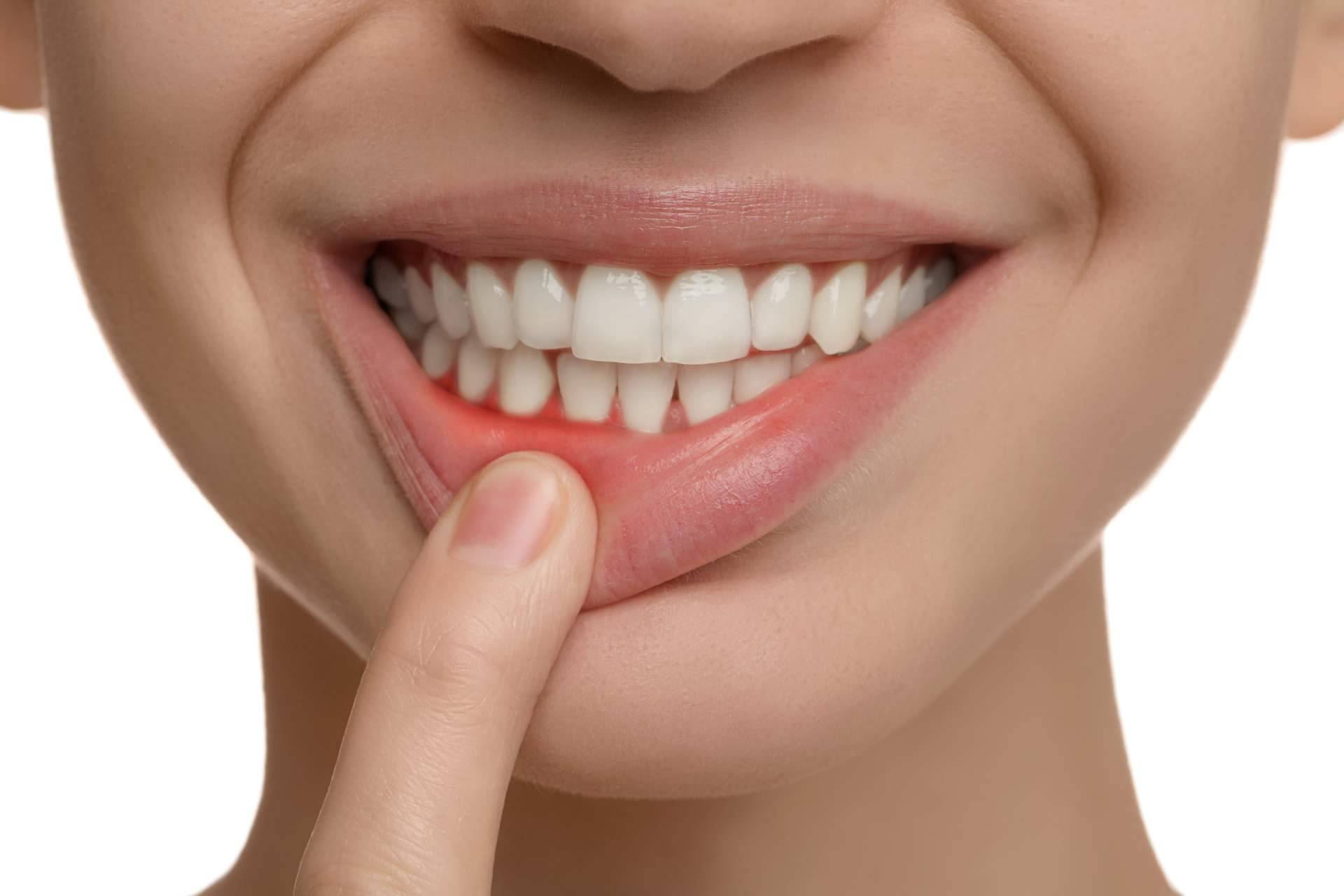 ¿Cómo tratar la enfermedad de las encías?, por Clínica Dental Agudo Rosa