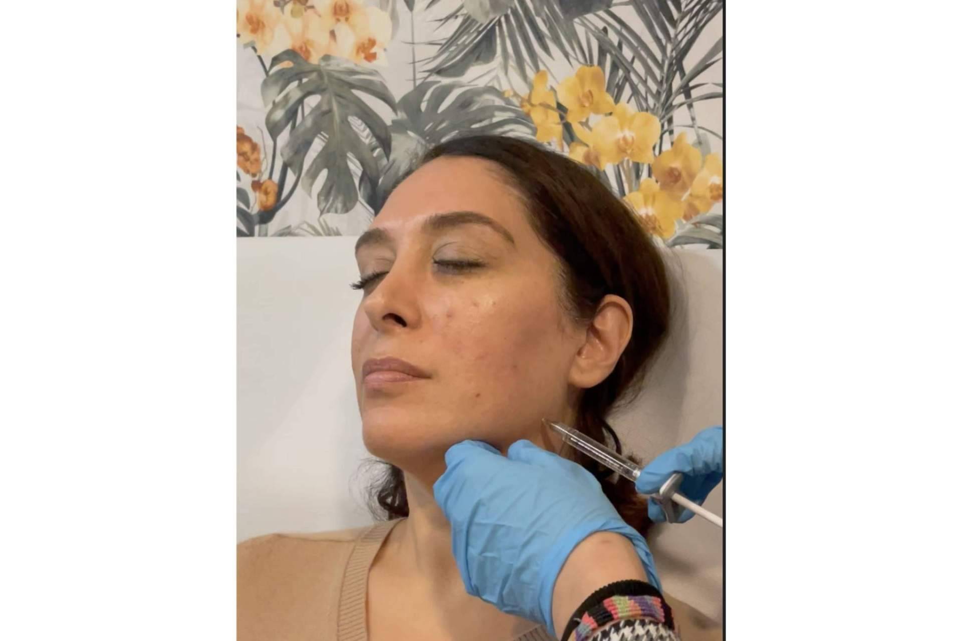 Dónde y por qué realizarse una marcación mandibular, con Cecilia Arthur