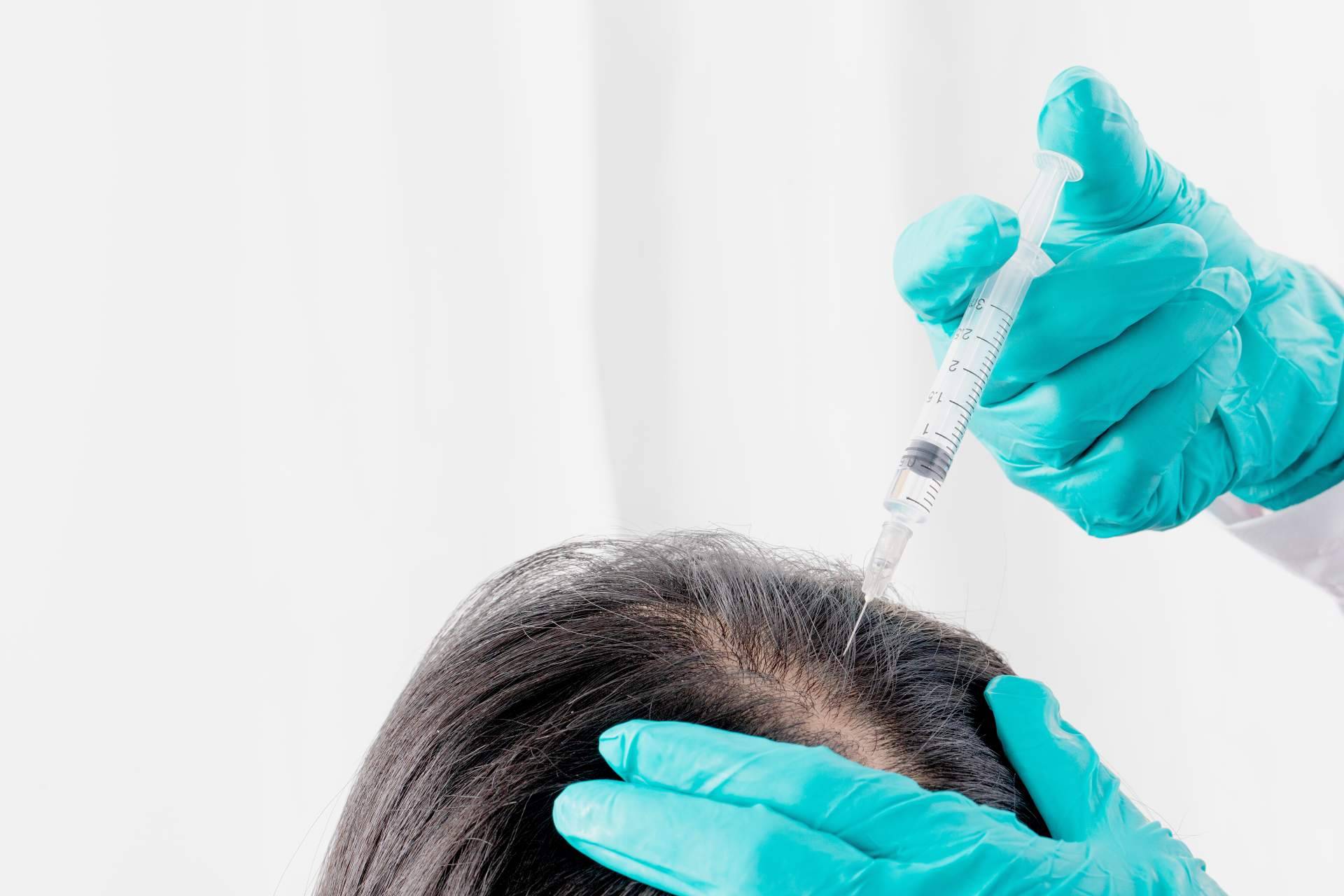 El tratamiento innovador de Centro Estética El Pilar que estimula el crecimiento del cabello, PRP capilar