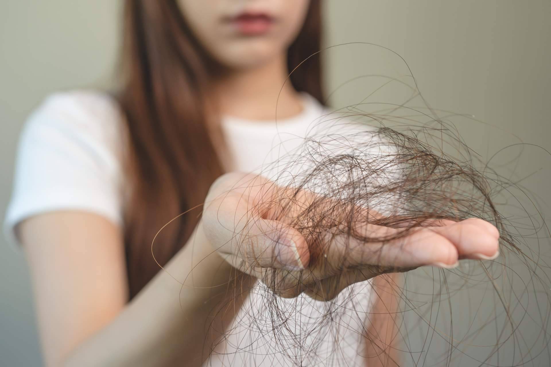 Evocapil y su solución de prevención ante la pérdida del cabello