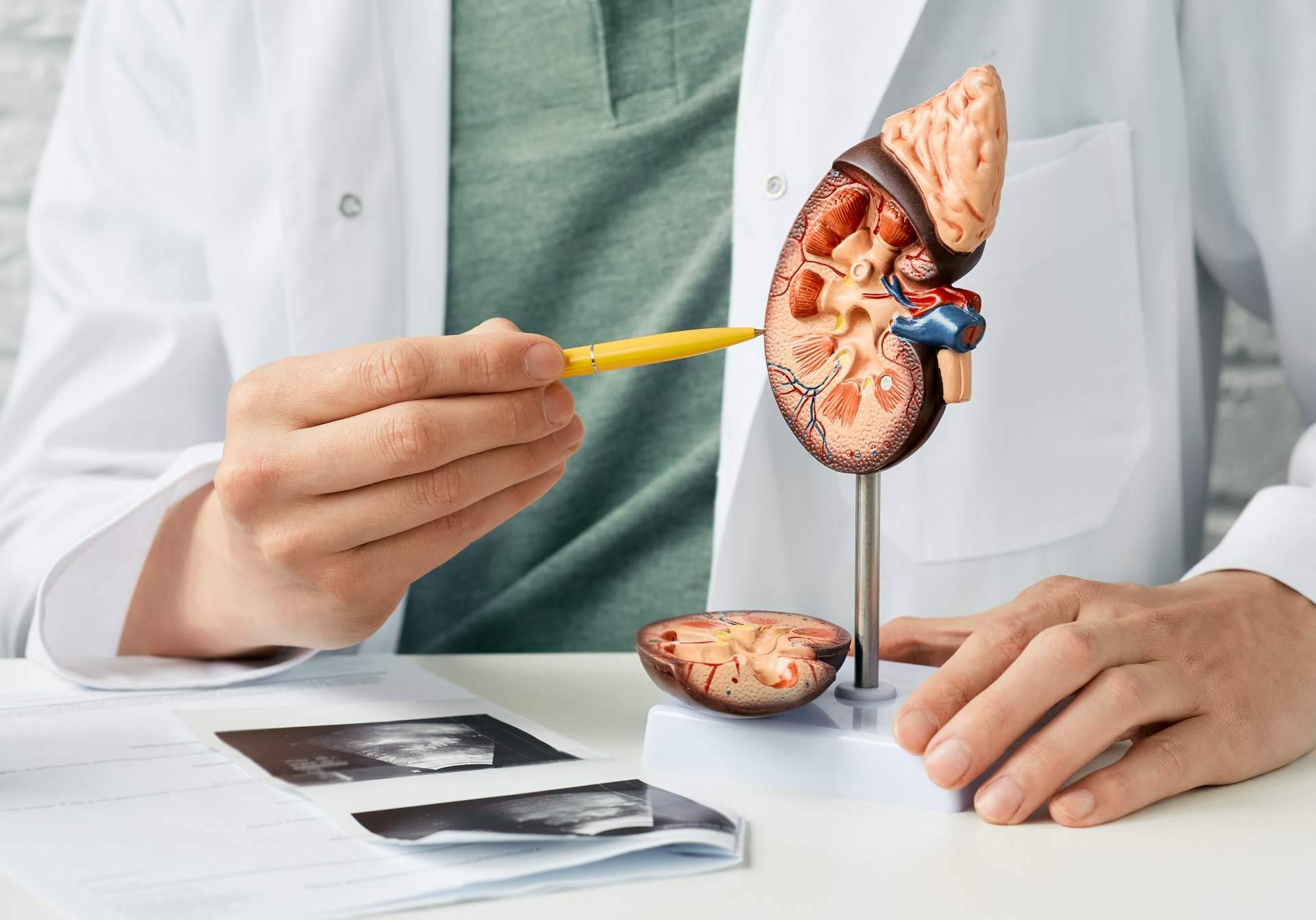 Todo sobre el cáncer de riñón. Causas, diagnóstico y tratamiento, por el Dr. Nelson Díez