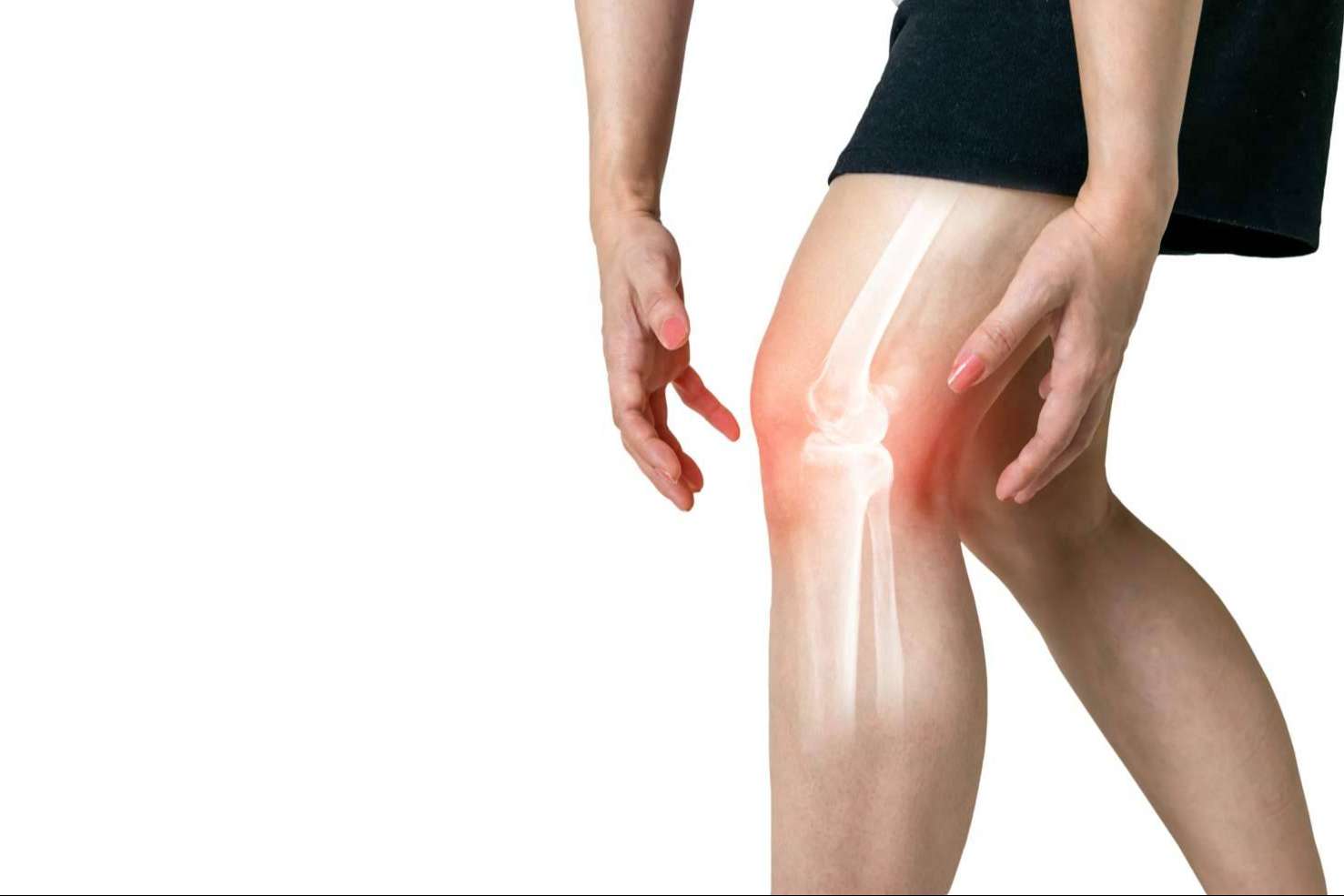 La colaboración de iXalud con la asociación de pacientes de artrosis y osteoporosis OAFI