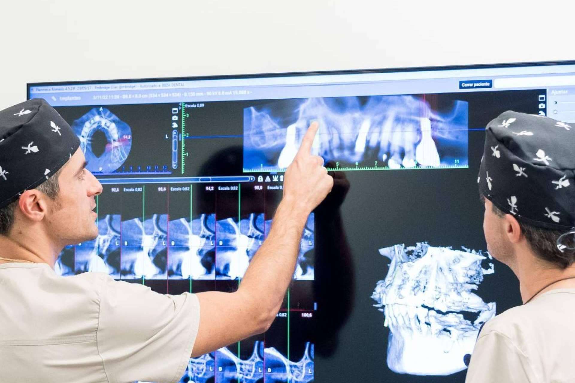 La innovadora técnica de restauración dental, implantes All on 4
