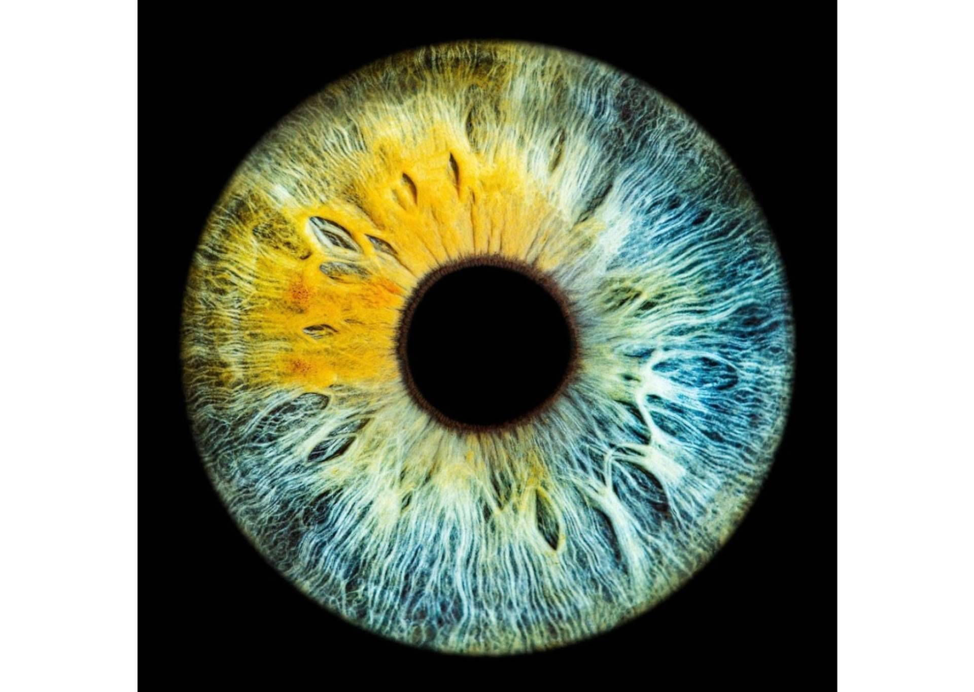 La clínica Eyecos advierte que las enfermedades metabólicas pueden cambiar el color de los ojos