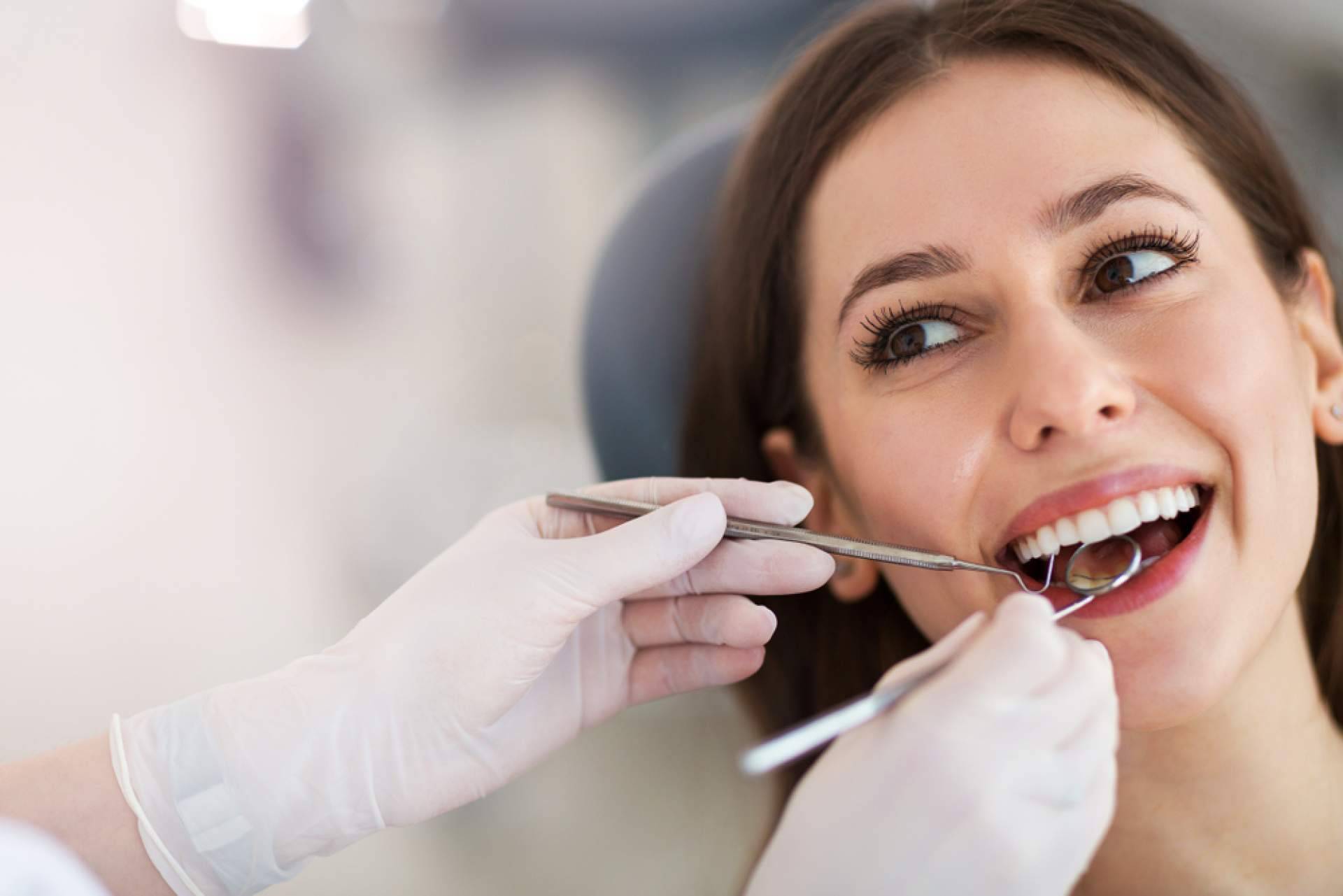 Beneficios de los dientes limados para carillas, con Carlos Saiz Smile