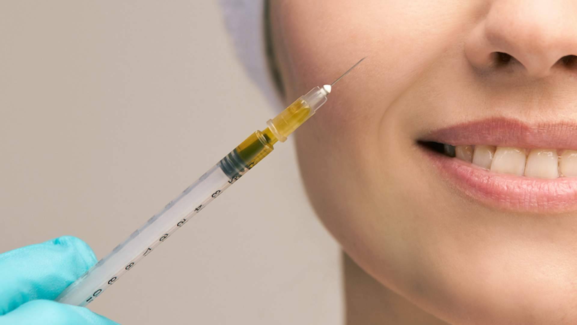 Centro Estética El Pilar y su tratamiento de plasma rico en plaquetas facial