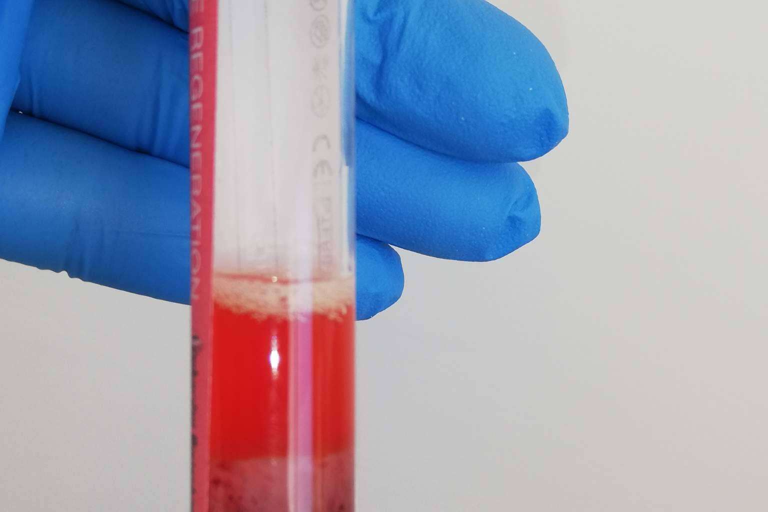 Clínica Biorigenera cuenta con expertos en terapias con células madre