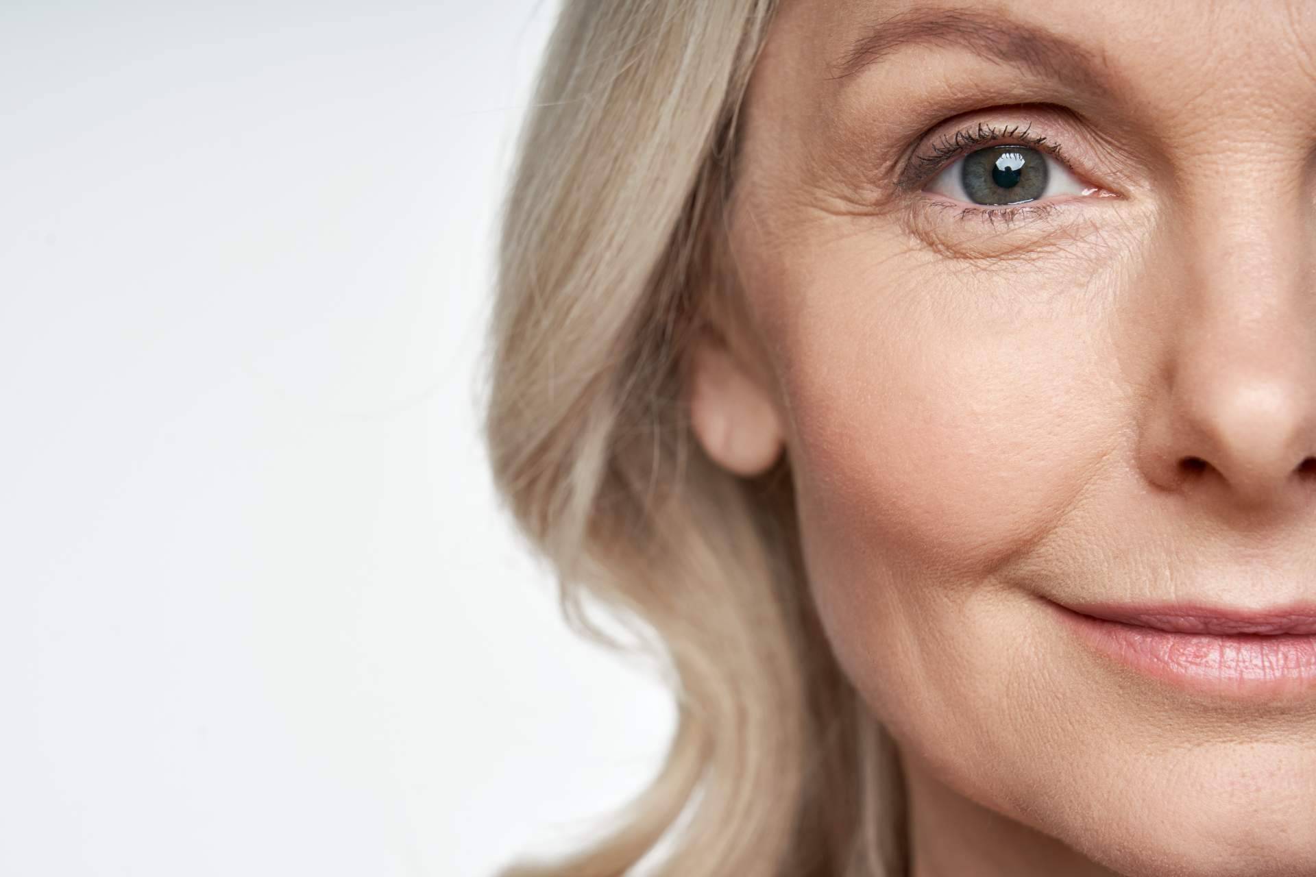 Los beneficios del dermapen para poros y arrugas, con G&G Beauty