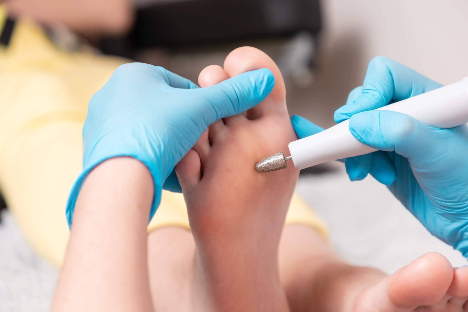 En el Centro Médico El Pilar, podología en Madrid