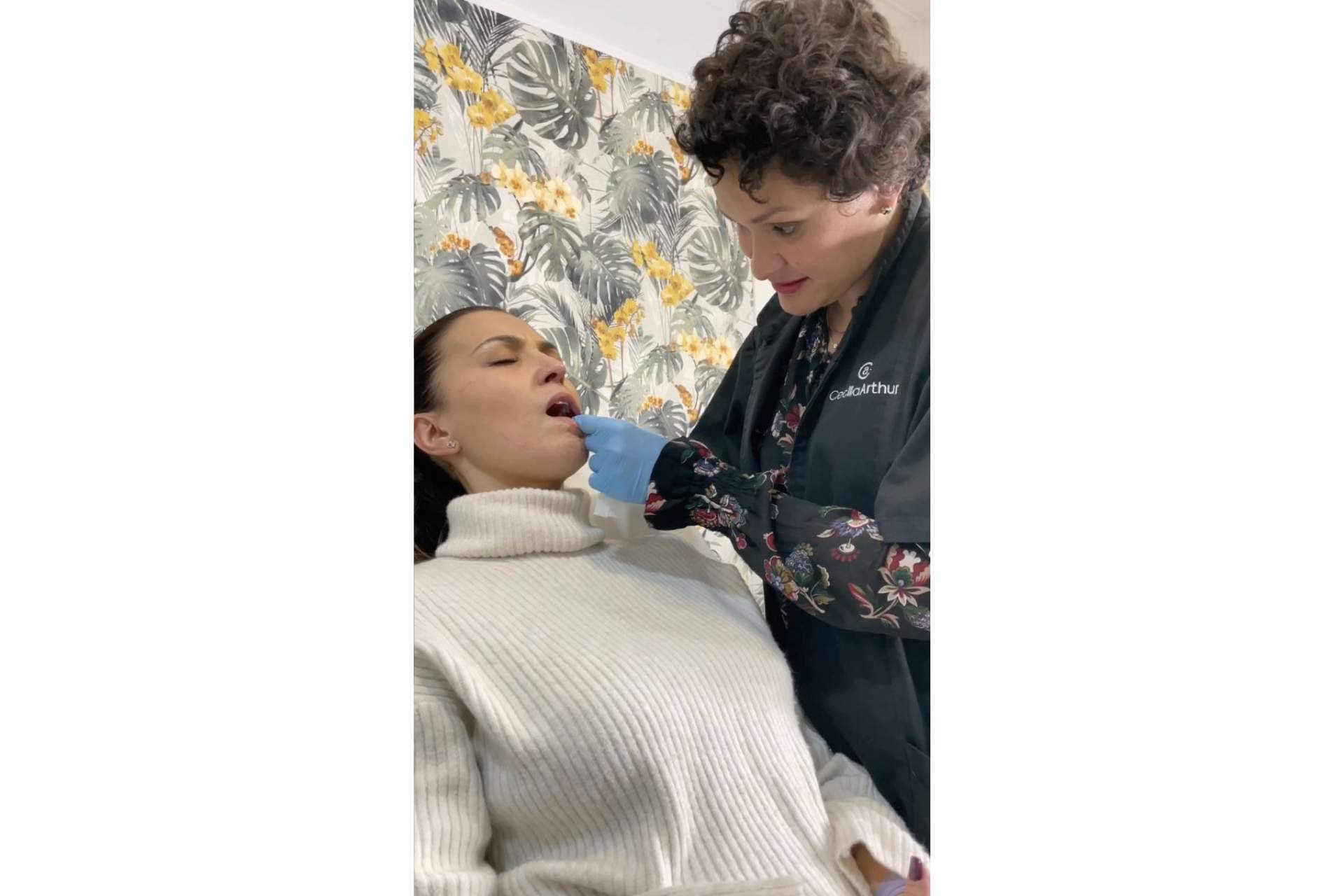 Tratamientos faciales para un rostro perfecto; aumento de labios con Cecilia Arthur