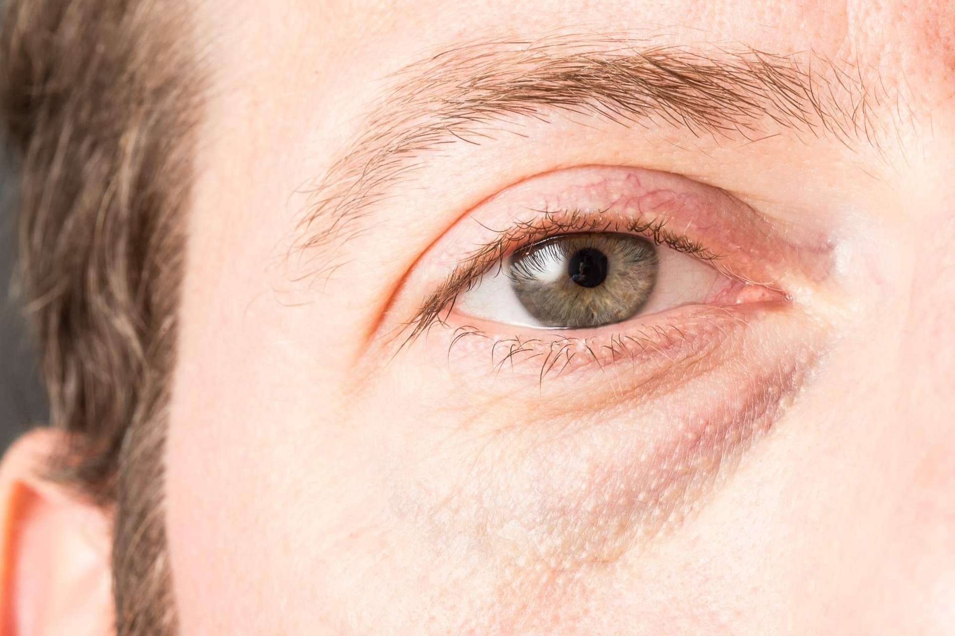 Innovación en el cuidado masculino; el tratamiento Banzeye para las ojeras