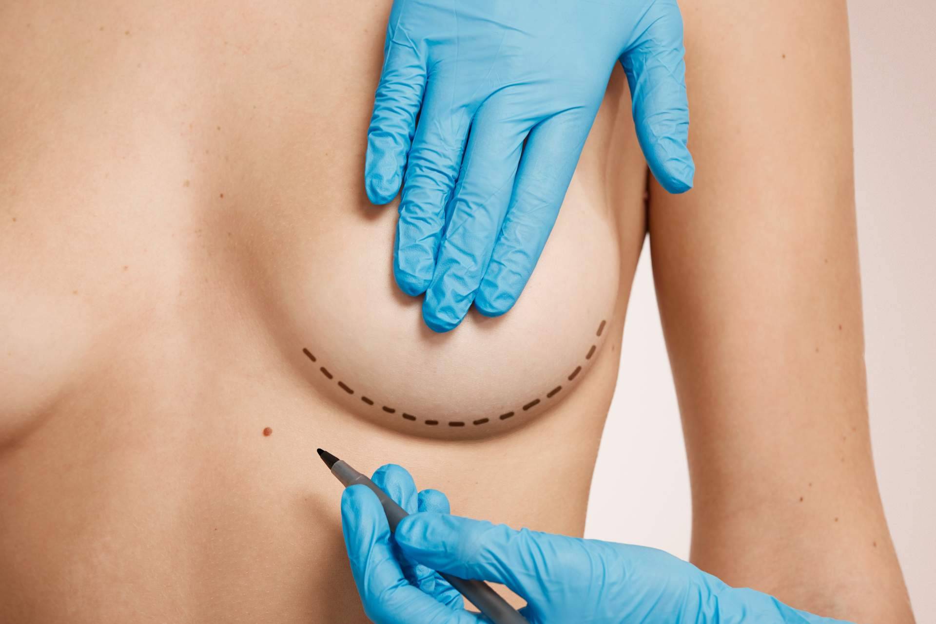 Beauty&Beauty apuesta por la expansión y la cirugía estética de calidad en España