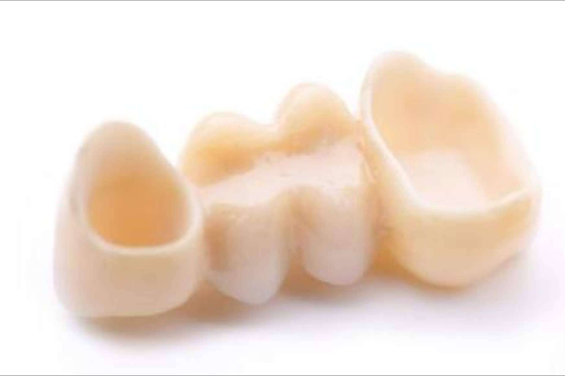 La Clínica Dental Jorge del Corral, en Hortaleza, innova con prótesis fijas de zirconio diseñadas por ordenador
