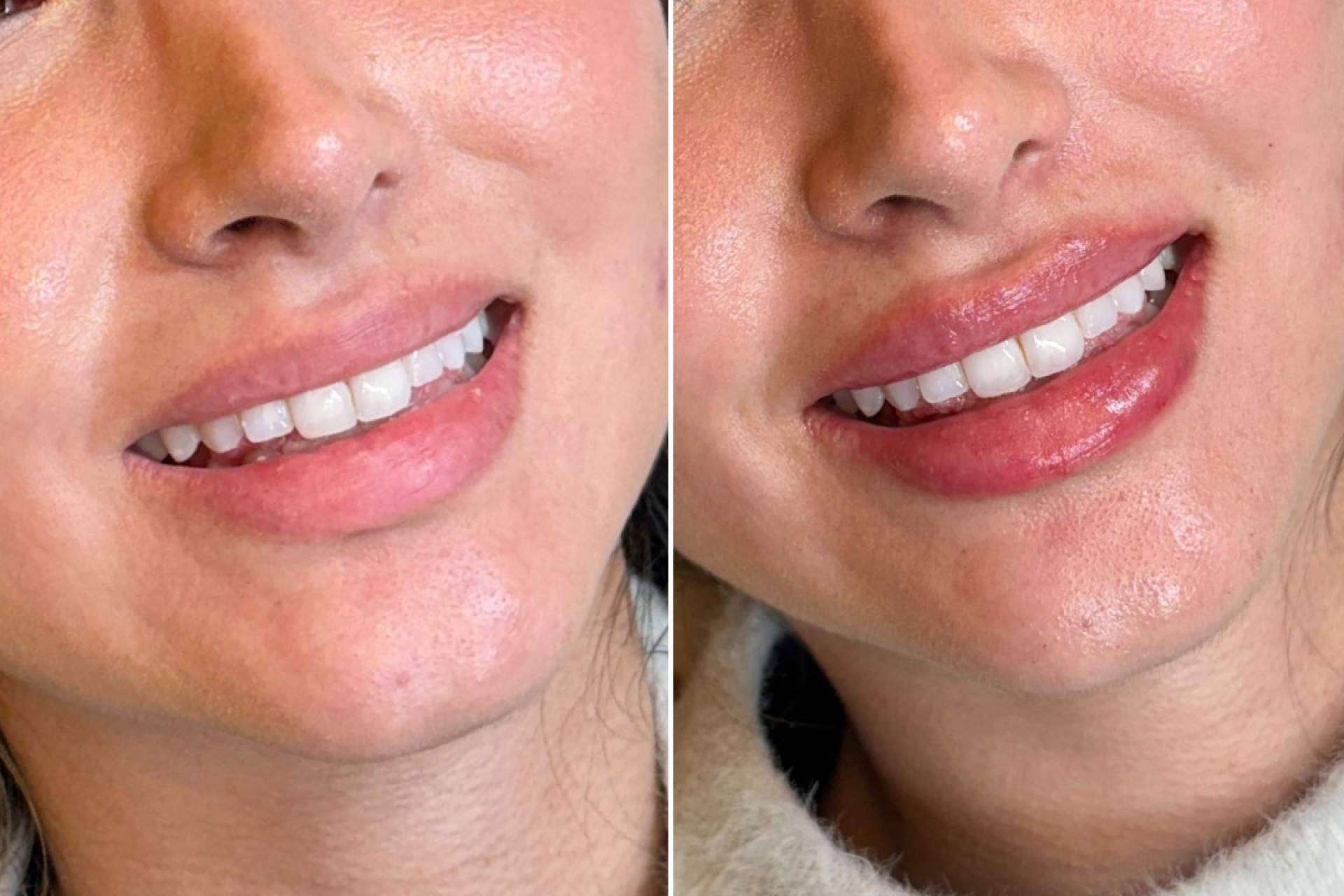 Glow Lips de Holaglow, la nueva referencia en armonización labial sin artificios