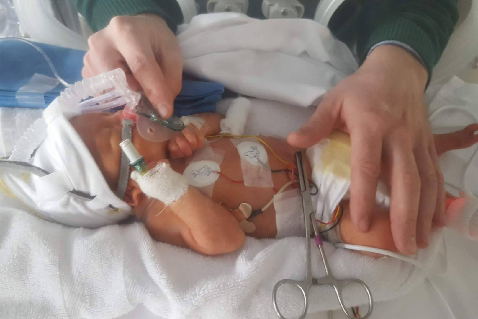 Día Mundial del Niño Prematuro; miles de familias españolas enfrentan retos que no se ven